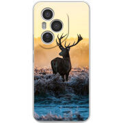 Чохол BoxFace Honor 400 Pro 