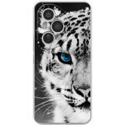 Чохол BoxFace Honor 400 Pro 