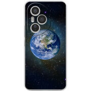 Чохол BoxFace Honor 400 Pro 