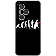 Чохол BoxFace Honor 400 Pro 