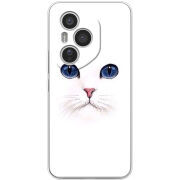 Чохол BoxFace Honor 400 Pro 