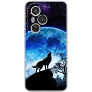 Чохол BoxFace Honor 400 Pro 