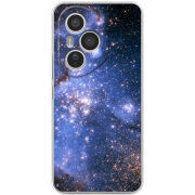 Чохол BoxFace Honor 400 Pro 