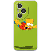 Чохол BoxFace Honor 400 Pro 