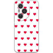 Чохол BoxFace Honor 400 Pro 