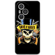 Чохол BoxFace Honor 400 Pro 