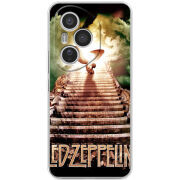 Чохол BoxFace Honor 400 Pro 