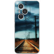 Чохол BoxFace Honor 400 Pro 