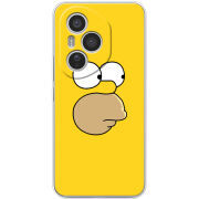 Чохол BoxFace Honor 400 Pro 