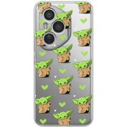 Прозорий чохол BoxFace Honor 400 Pro Pattern Baby Yoda