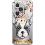 Прозорий чохол BoxFace Honor 400 Pro 