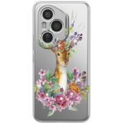 Чохол зі стразами Honor 400 Pro Deer with flowers