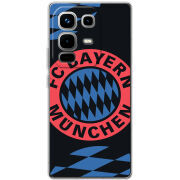Чохол BoxFace Infinix Note 50 Pro Plus FC Bayern