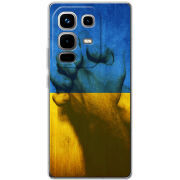 Чохол BoxFace Infinix Note 50 Pro Plus Handshake