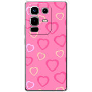 Чохол BoxFace Infinix Note 50 Pro Plus Sugar Hearts