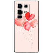 Чохол BoxFace Infinix Note 50 Pro Plus 