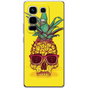 Чохол BoxFace Infinix Note 50 Pro Plus Pineapple Skull