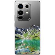 Прозорий чохол BoxFace Infinix Note 50 Pro Plus Green Mountain