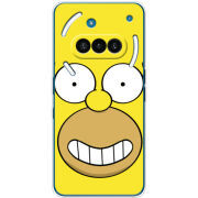 Чохол BoxFace Nothing Phone (3a) 