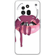 Чохол BoxFace Nothing Phone (3a) Pro 