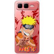 Прозорий чохол BoxFace Infinix Smart 10 Plus Naruto