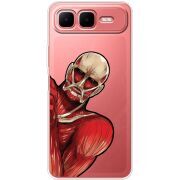 Прозорий чохол BoxFace Infinix Smart 10 Plus Титан