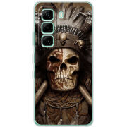 Чохол BoxFace Infinix Hot 60i 