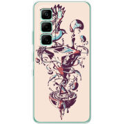 Чохол BoxFace Infinix Hot 60i 