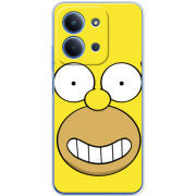 Чохол BoxFace Poco C85 