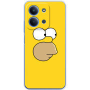 Чохол BoxFace Poco C85 