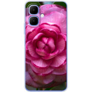Чохол BoxFace Infinix Smart 10 