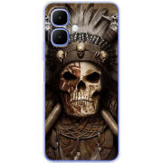 Чохол BoxFace Infinix Smart 10 