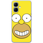 Чохол BoxFace Infinix Smart 10 