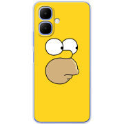 Чохол BoxFace Infinix Smart 10 