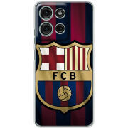 Чохол BoxFace Motorola Moto G56 