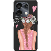 Чохол BoxFace Umidigi G9 You Can