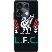 Чохол BoxFace Umidigi G9 L. F. C.