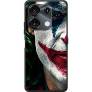 Чохол BoxFace Umidigi G9 Joker Background
