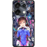 Чохол BoxFace Umidigi G9 Overwatch D.VA
