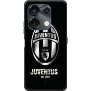 Чохол BoxFace Umidigi G9 