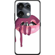 Чохол BoxFace Umidigi G9 