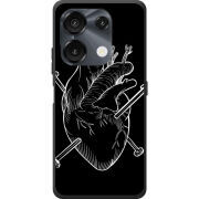 Чохол BoxFace Umidigi G9 