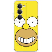 Чохол BoxFace Xiaomi Redmi 15 171 mm 