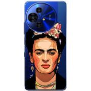 Прозорий чохол BoxFace TCL 50 Pro NxtPaper 5G Фрида Кало