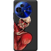 Чорний чохол BoxFace TCL 50 Pro NxtPaper 5G Титан