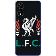 Чохол BoxFace TCL 505 L. F. C.