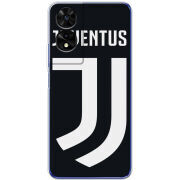 Чохол BoxFace TCL 505 FC J