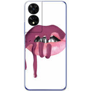 Чохол BoxFace TCL 505 