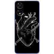 Чохол BoxFace TCL 505 