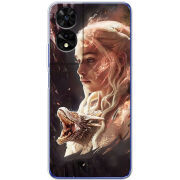 Чохол BoxFace TCL 505 